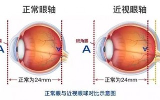 左右眼视力正常是多少，左右眼视力正常是多少值