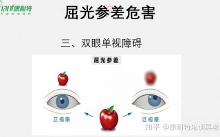 怎么看镜片左右眼，怎么看镜片左右眼有没有装反