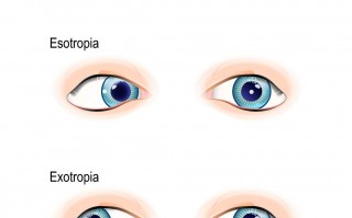 美瞳直径指什么意思，