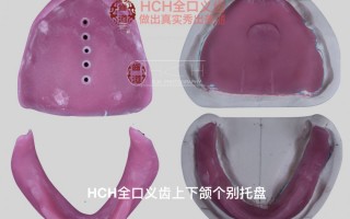 树脂片有什么用，树脂哨片