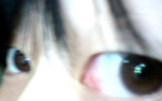 戴隐形眼睛红怎么办，戴隐形眼睛红怎么办啊